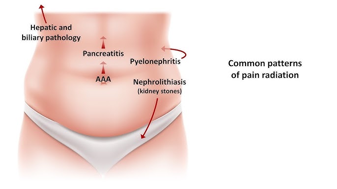 Abdominal Colic