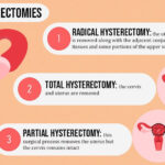 Abdominal Hysterectomy Infection Prevention