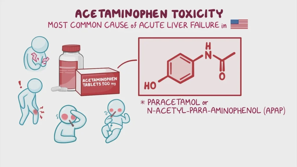 Acetaminophen Overdose