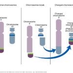 accelerated phase philadelphia chromosome positive chronic myelocytic leukemia