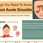 acute bacterial sinusitis