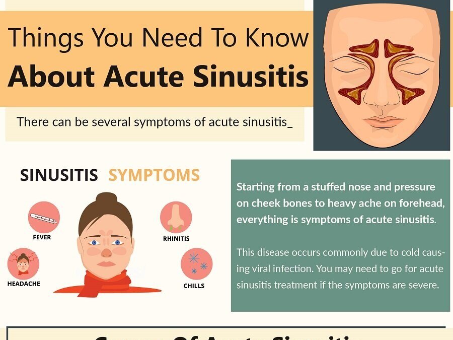 acute bacterial sinusitis