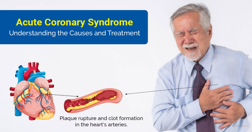 Acute Coronary Syndrome