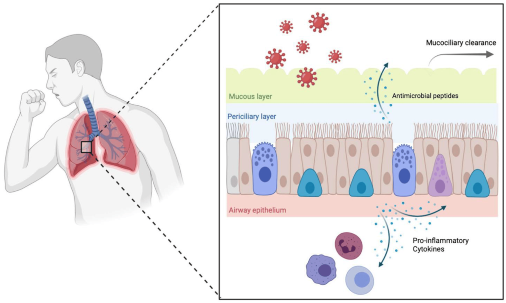 Acute Exacerbation of Obstructive Chronic Bronchitis Due to H flu