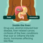 biliary obstruction with pruritus