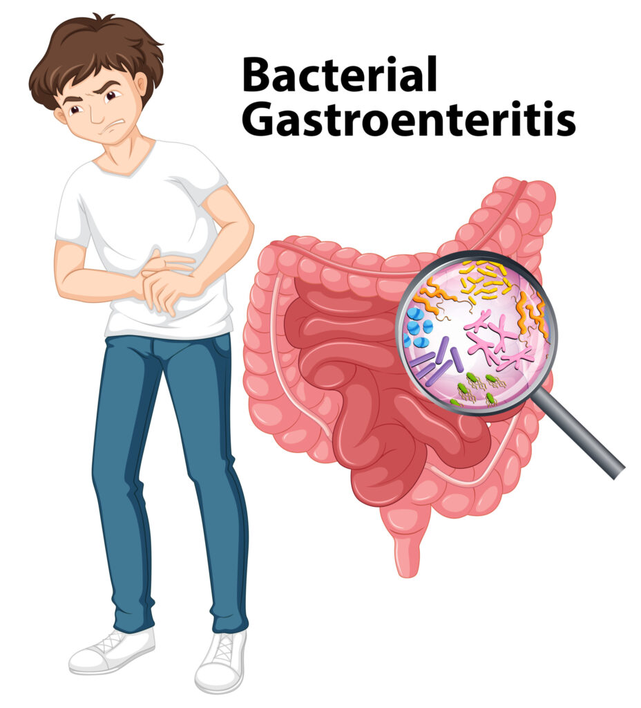 bacterial diarrhea