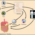 bacterial diarrhea