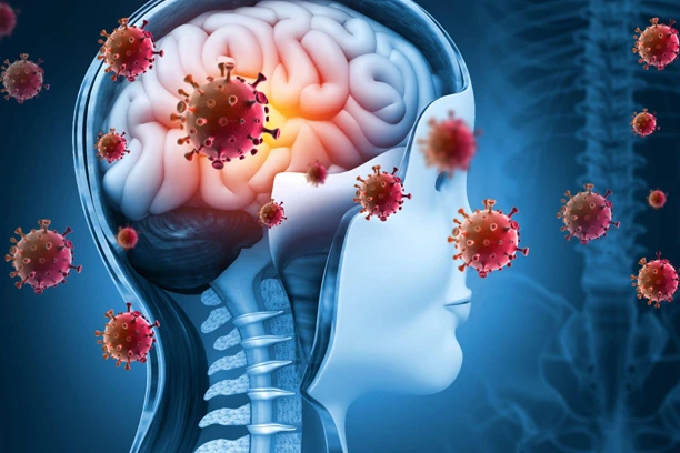 bacterial meningitis