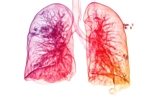 bacteroides empyema