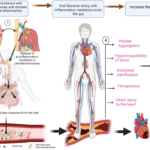 bacteroides endocarditis