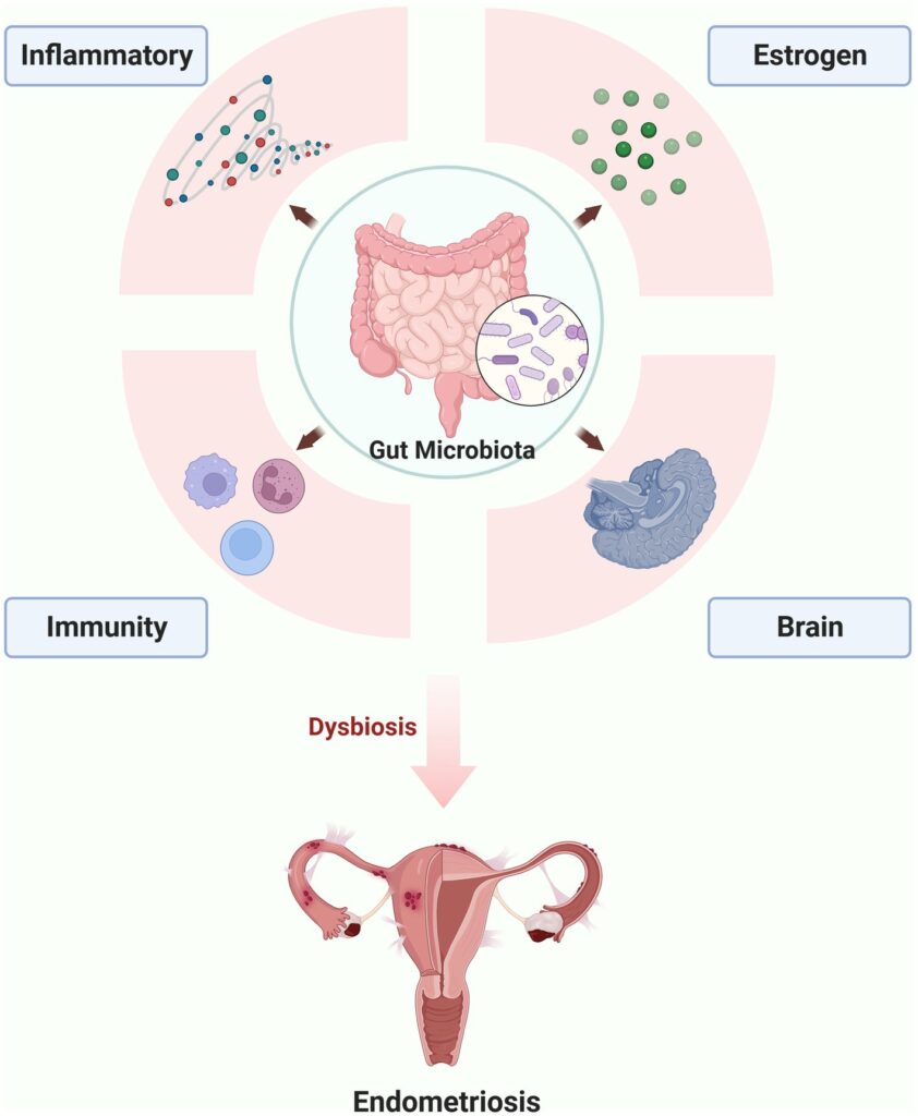 Bacteroides endometritis, pelvic inflammatory disease, anaerobic bacteria, uterine infection, gynecological health