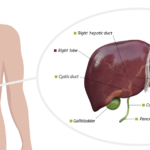 bacteroides liver abscess