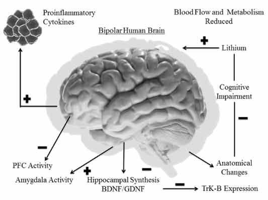 bipolar disorder in remission