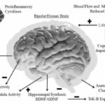 bipolar disorder in remission