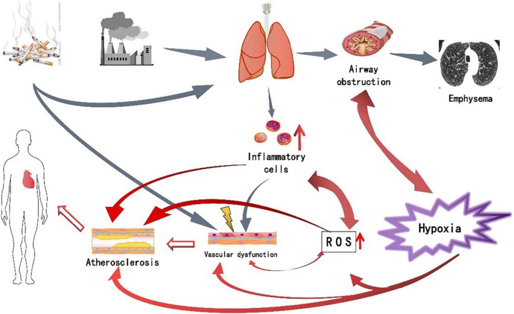 bronchospasm prevention with copd