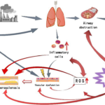 bronchospasm prevention with copd