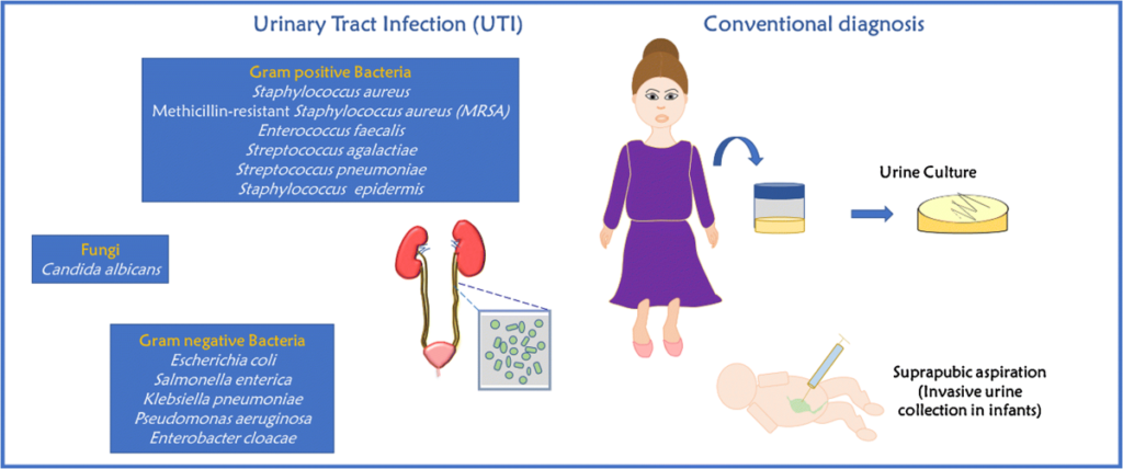 candidal urinary tract infection