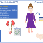 candidal urinary tract infection