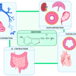 carcinoid crisis