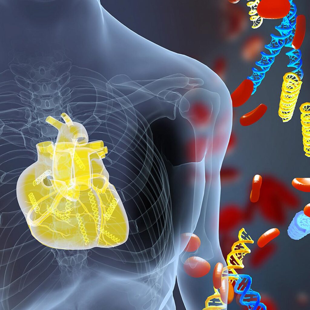 cardiac transplant rejection