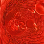 chemotherapy-induced anemia