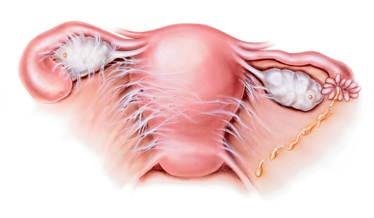 chlamydia trachomatis pelvic inflammatory disease