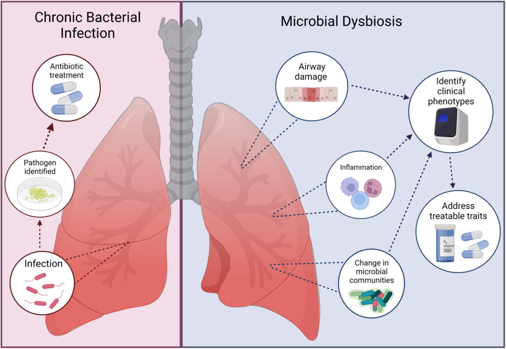 chronic bronchitis with bacterial exacerbation