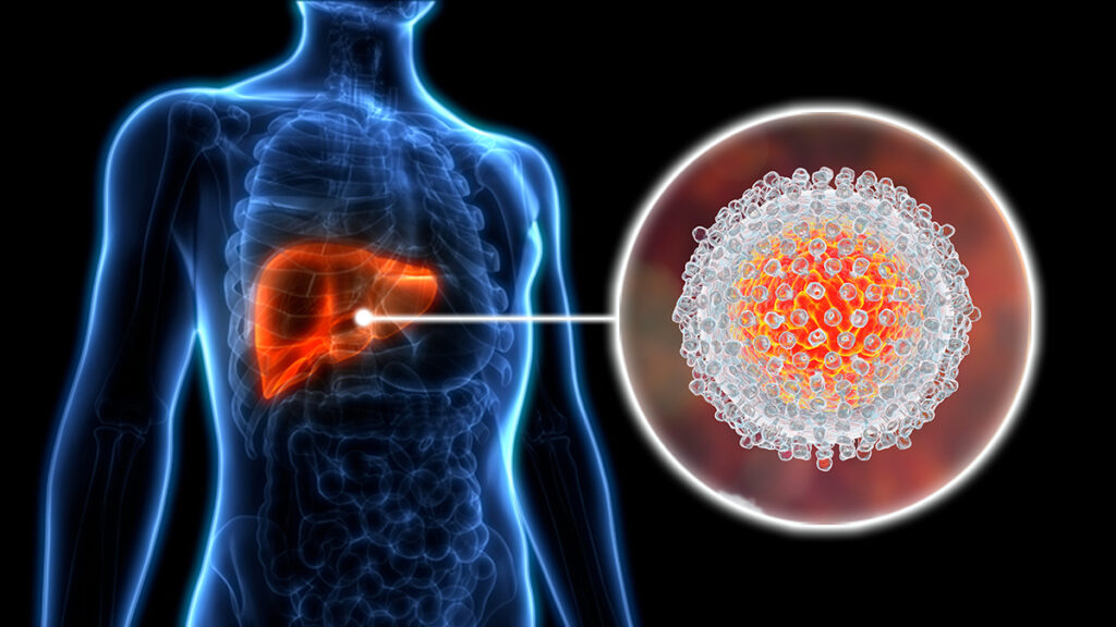 chronic hepatitis c