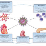 chronic hepatitis c - genotype 5