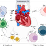 chronic indeterminate chagas disease