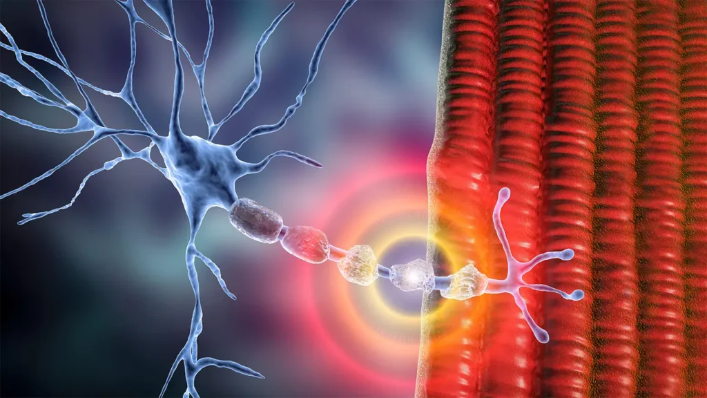 chronic inflammatory demyelinating polyneuropathy