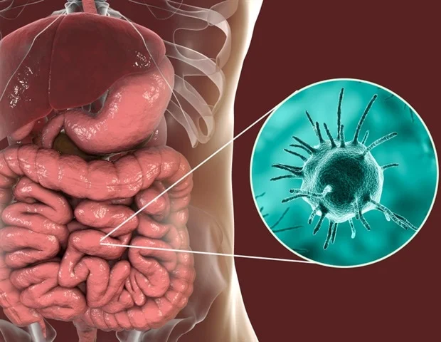 chronic intestinal amebiasis