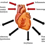 chronic iron overload due to repeated blood transfusions