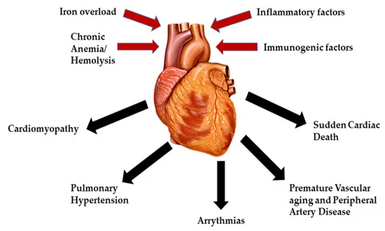 chronic iron overload due to repeated blood transfusions