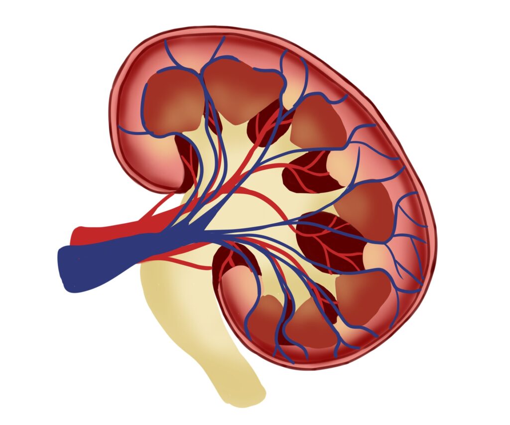 chronic kidney disease with albuminuria