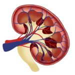 chronic kidney disease with albuminuria