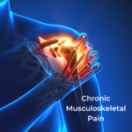 chronic musculoskeletal pain