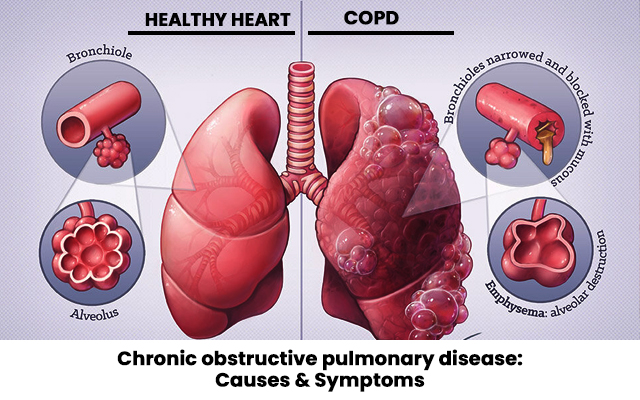 chronic obstructive pulmonary disease with bronchospasm