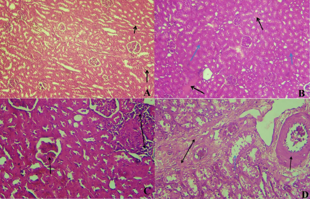 citrobacter pneumonia