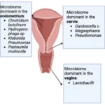 clostridium endometritis