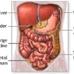 clostridium peritonitis