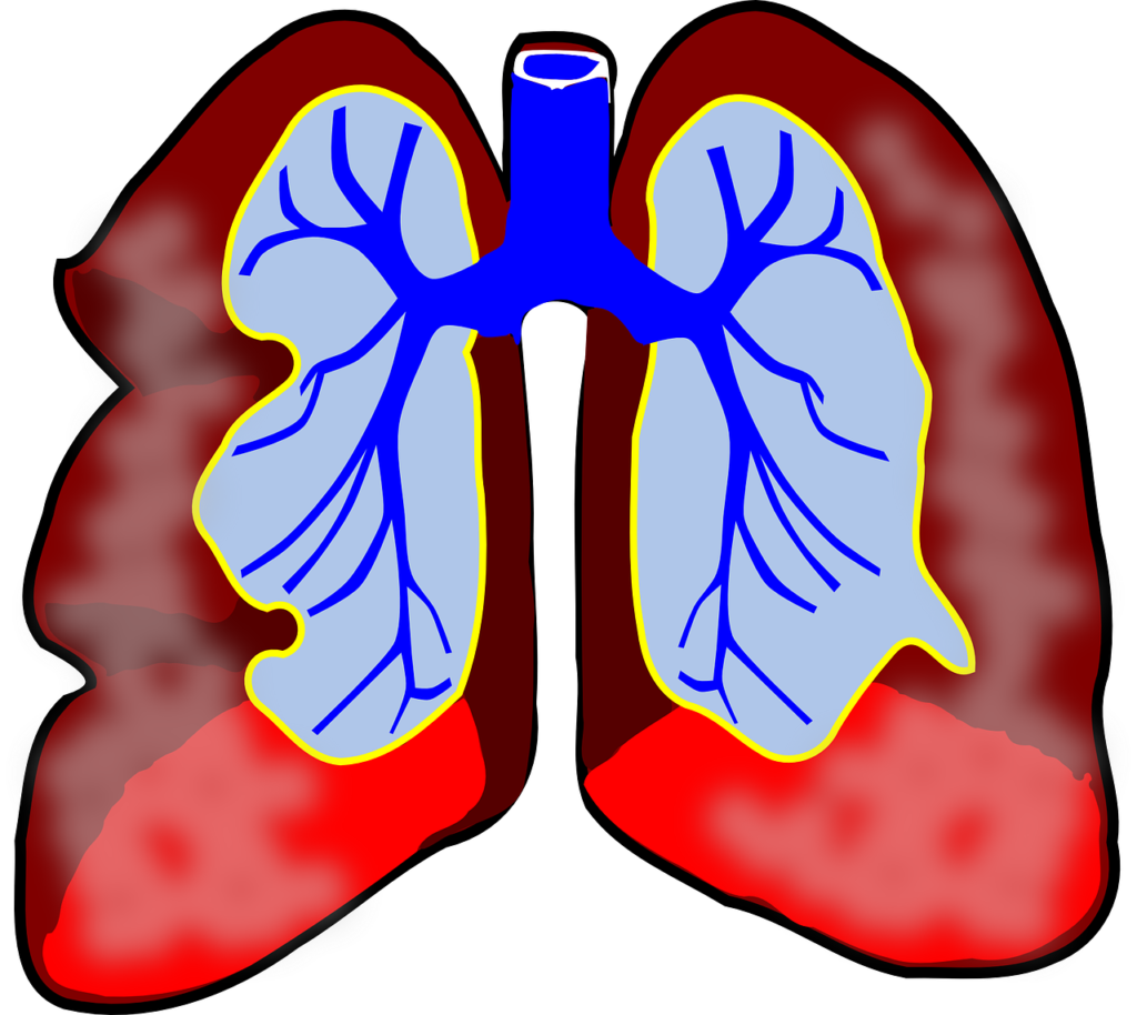 bacteroides pneumonia