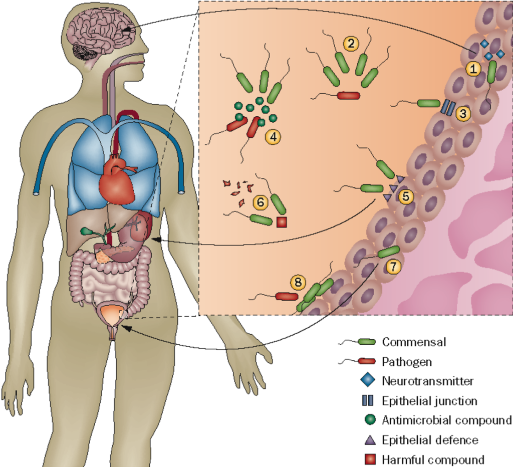 enterococcus urinary tract infection