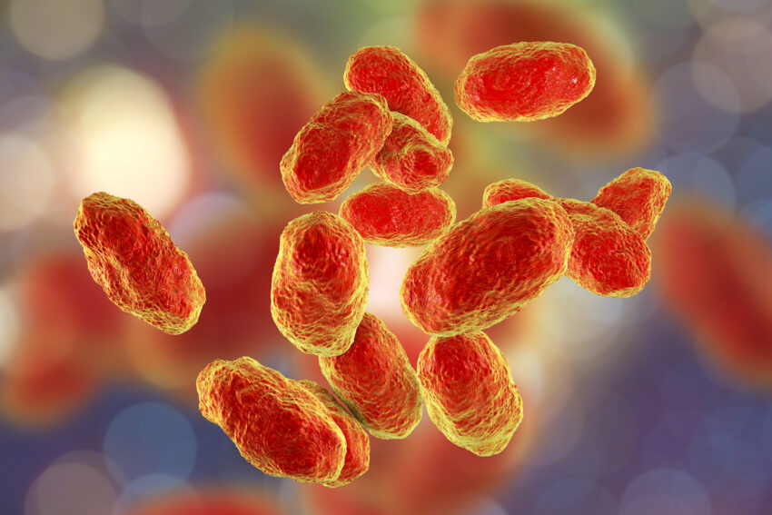 Acute Haemophilus influenzae Bacterial Sinusitis