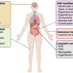 Acute Hepatic Porphyria