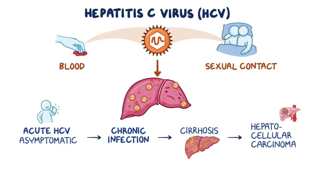 Acute Hepatitis C