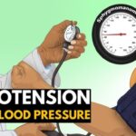 Acute Hypotension