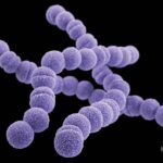 Acute Streptococcus Pyogenes Bacterial Sinusitis