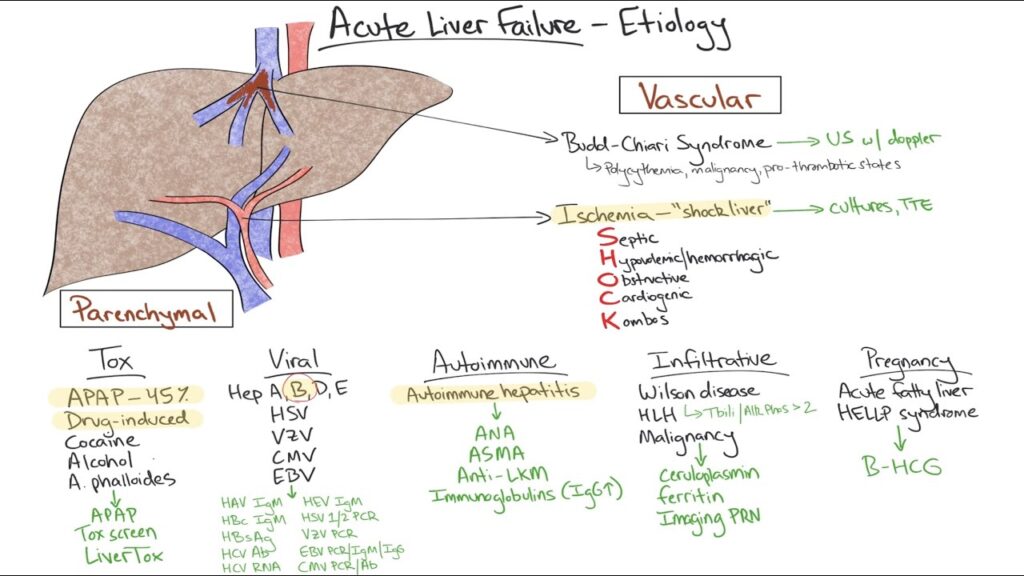 acute hepatic failure