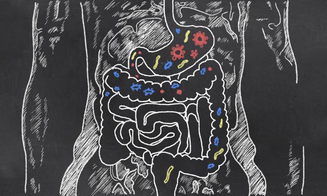 complicated streptococcus peritonitis